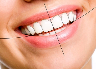 Patient receiving a smile makeover consultation